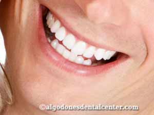 Dental Whitening in Los Algodones
