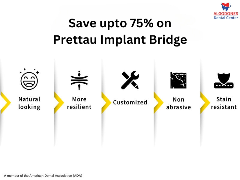 Save upto 75% on Prettau Implant Bridge